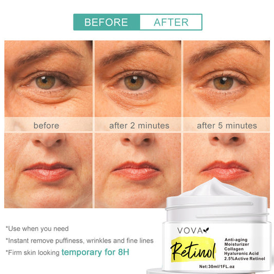 Anti-Aging Moisturizer Face Cream